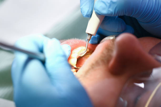Best Cracked Tooth Emergency Dentist  in Cicero, IL